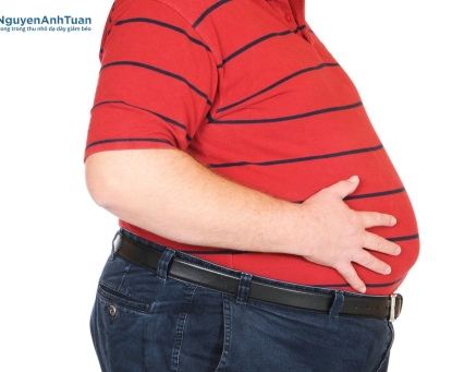 Béo phì: Không chỉ là vấn đề thẩm mỹ, mà là một bệnh lý nghiêm trọng